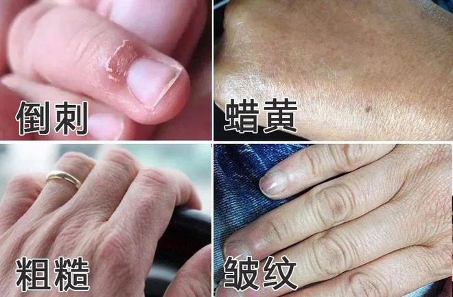 霜！跪求你买这8支好用到想报警！九游会网址是多少冬日的第一支护手(图4)